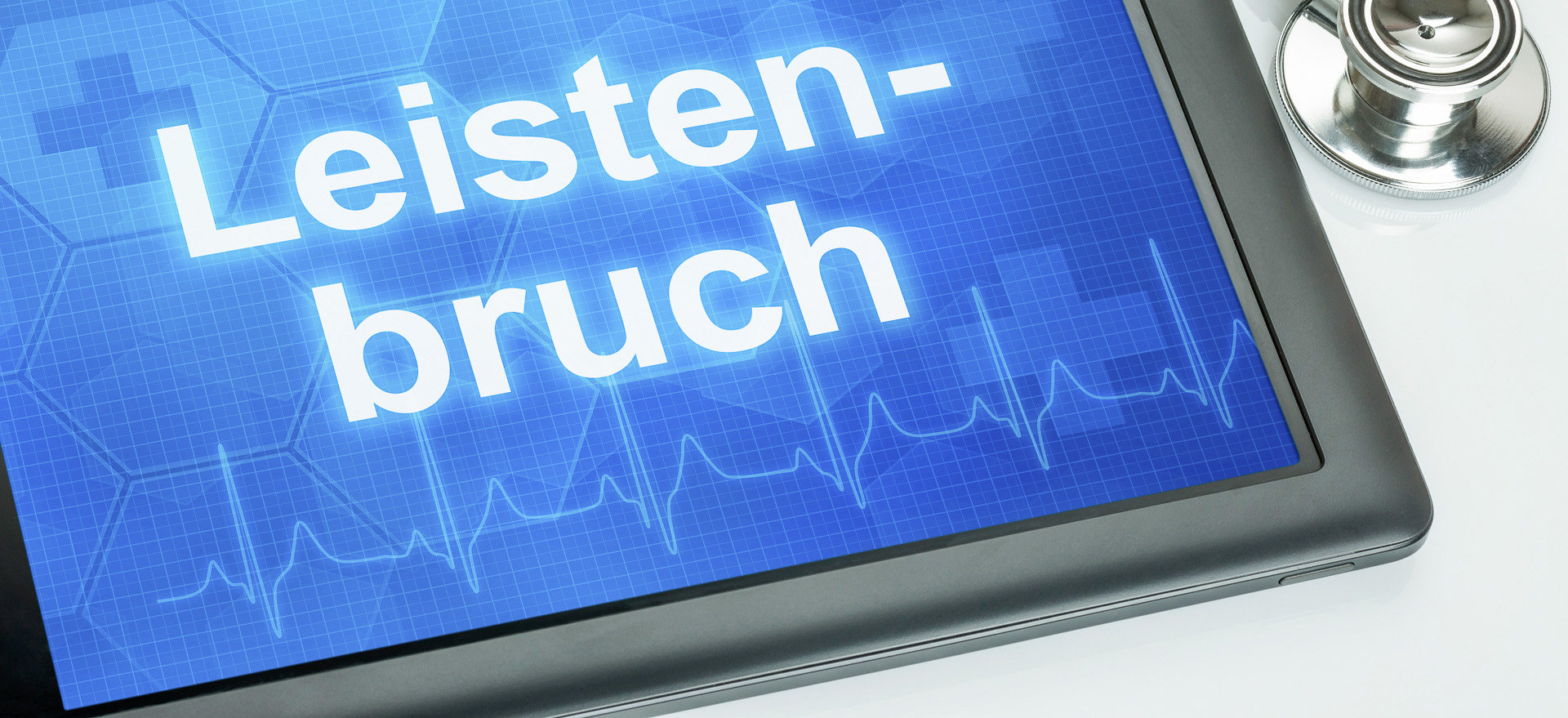 Zum Artikel: Was sind eigentlich Bauchwandbrüche, auch Hernien genannt?