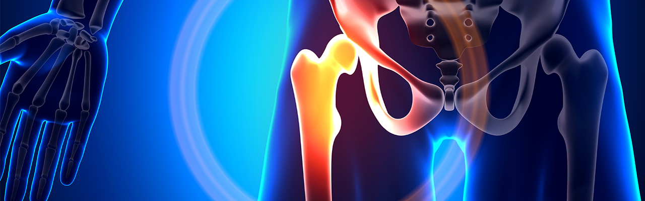 Zum Artikel: Hüftbeschwerden und Mobilität – Chancen und Risiken
